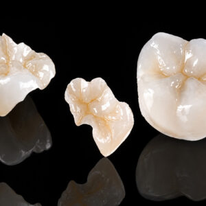 Biomimetic Restorations