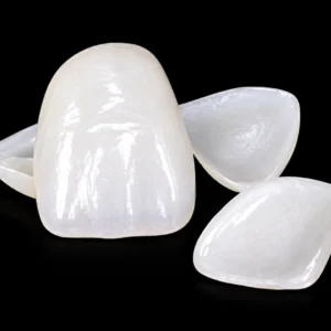 Laminate Veneers
