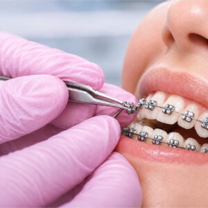 ORTHODONTICS / DENTAL BRACES
